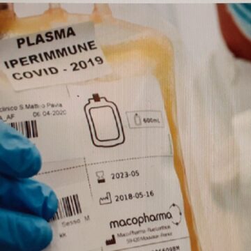 L’ appello dell’infettivologo Cascio:” Possibile donare Plasma iperimmune presso la UOC di Medicina Trasfusionale Policlinico di Palermo”. Ecco come fare